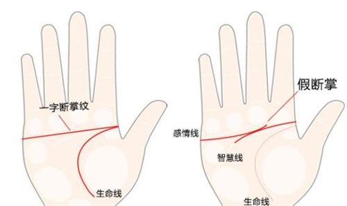 断掌纹 断掌纹的孩子有什么说法