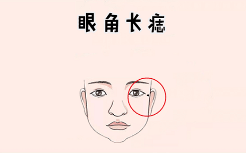 眼角有颗痣叫什么痣图解 右眼下眼角有颗痣叫什么痣