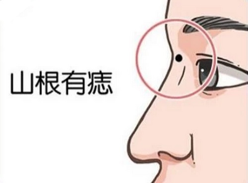 山根长痣说明什么 山根长痣预示什么相学