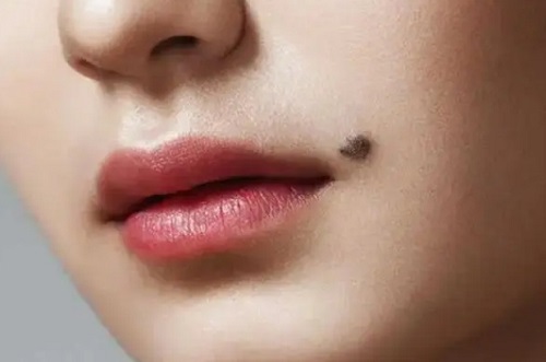 嘴巴嘴角右下方有痣的女人代表什么命运 右边嘴角下面有痣的女人面相好吗