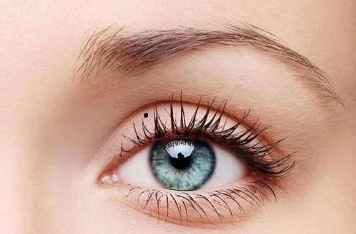 眼皮有痣的女人 眼皮有痣的女人代表什么意思 眼皮有痣的女人 眼皮有痣的女人代表什么意思