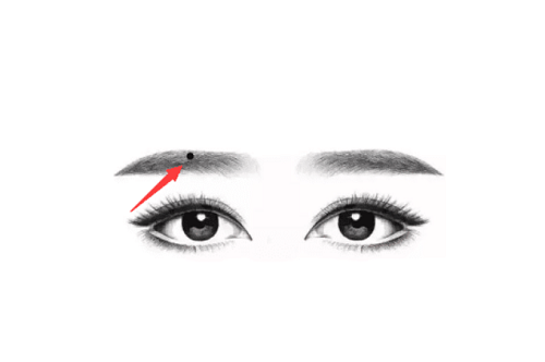 锁眉痣代表什么意义 锁眉痣代表什么意思?
