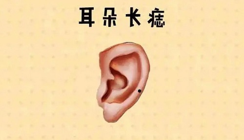 女人耳朵长痣面相图解 女人耳朵长痣面相图解大全