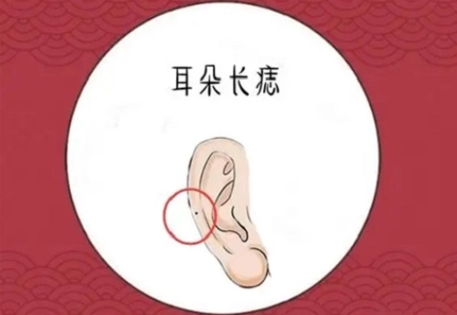 男人耳朵上有痣图解对照表 男人耳朵痣的位置与命运图