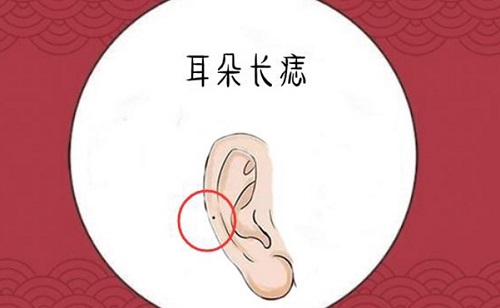 女人耳朵上长痣面相图 女人耳朵上有痣代表什么命运