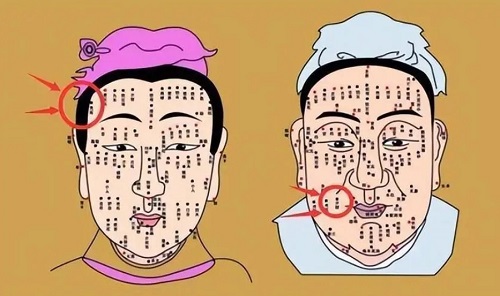 面部的痣好坏图解男 面部的痣好坏图解大全