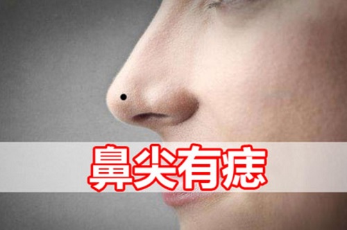 鼻尖上有痣的人好吗 鼻尖上有个痣从面相学是好还是不好
