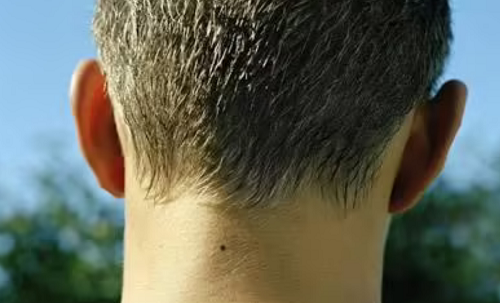 男人脖子上有痣图解大全 男人脖子上有痣代表什么