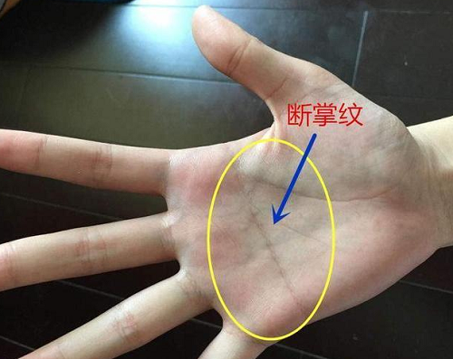 手有断掌是什么意思 男孩右手断掌是什么意思