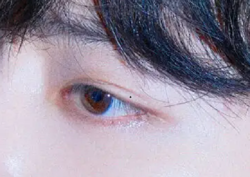 眼皮有痣的男人 眼皮有痣的男人面相