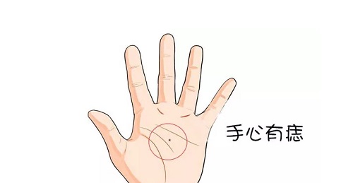 左手掌心有痣的女人好不好呢 左手掌心突然长了一颗红痣代表什么女人